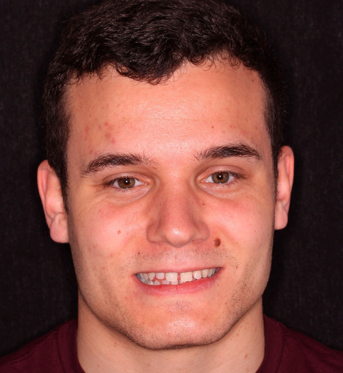 fotografía de antes