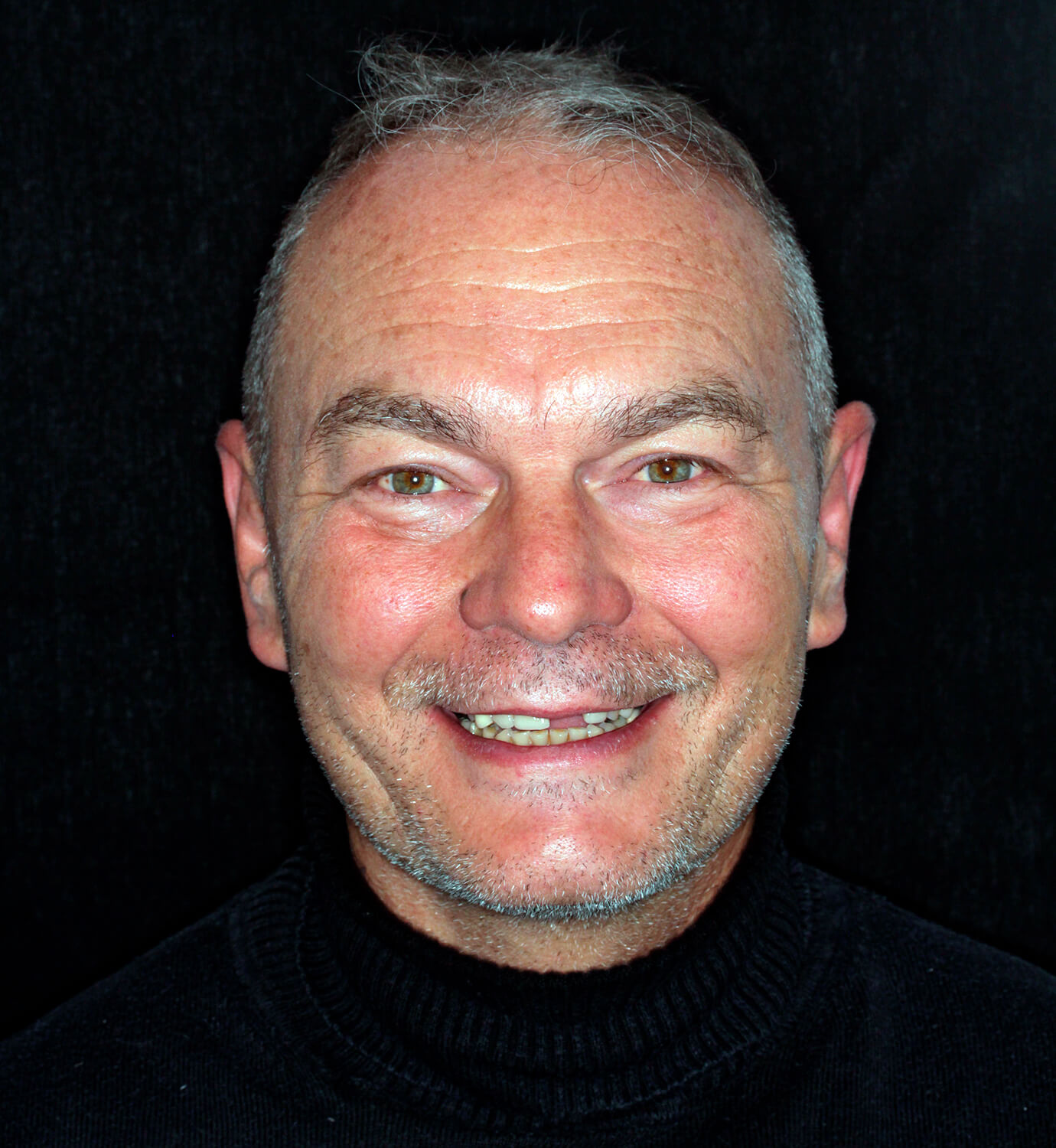 fotografía de antes