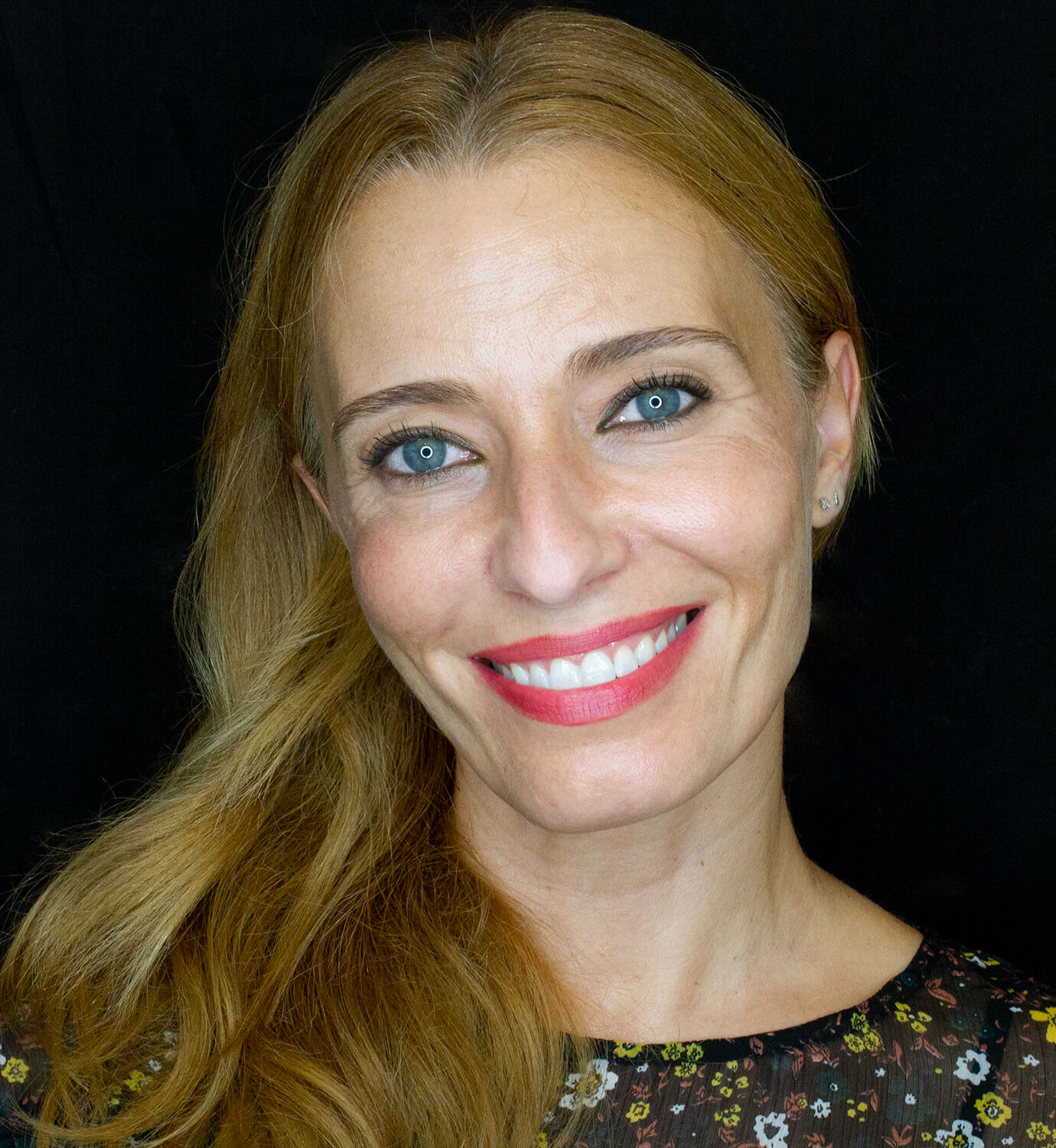 fotografía de después de ortodoncia con Invisalign