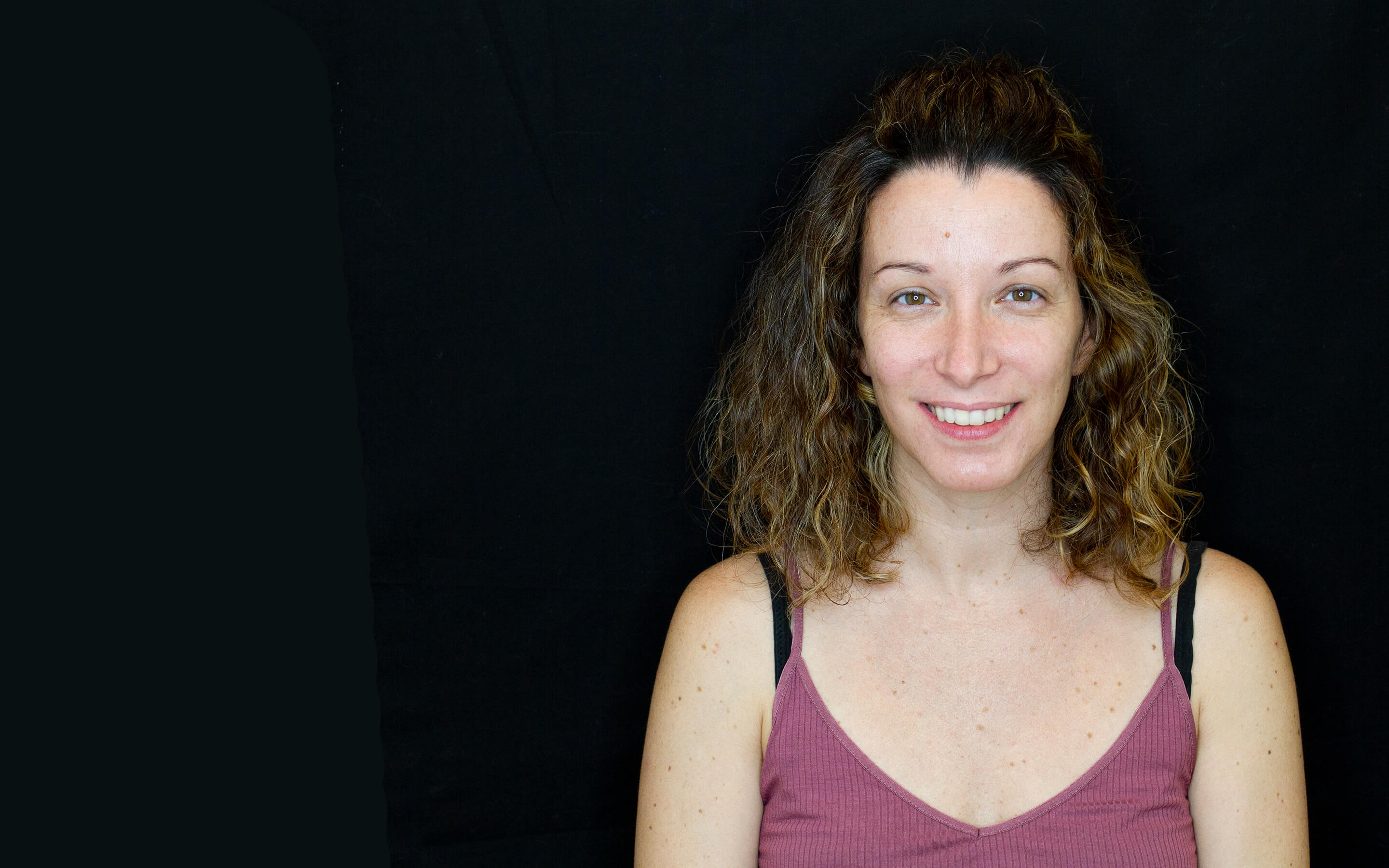 Caso antes y después de ortodoncia con Invisalign