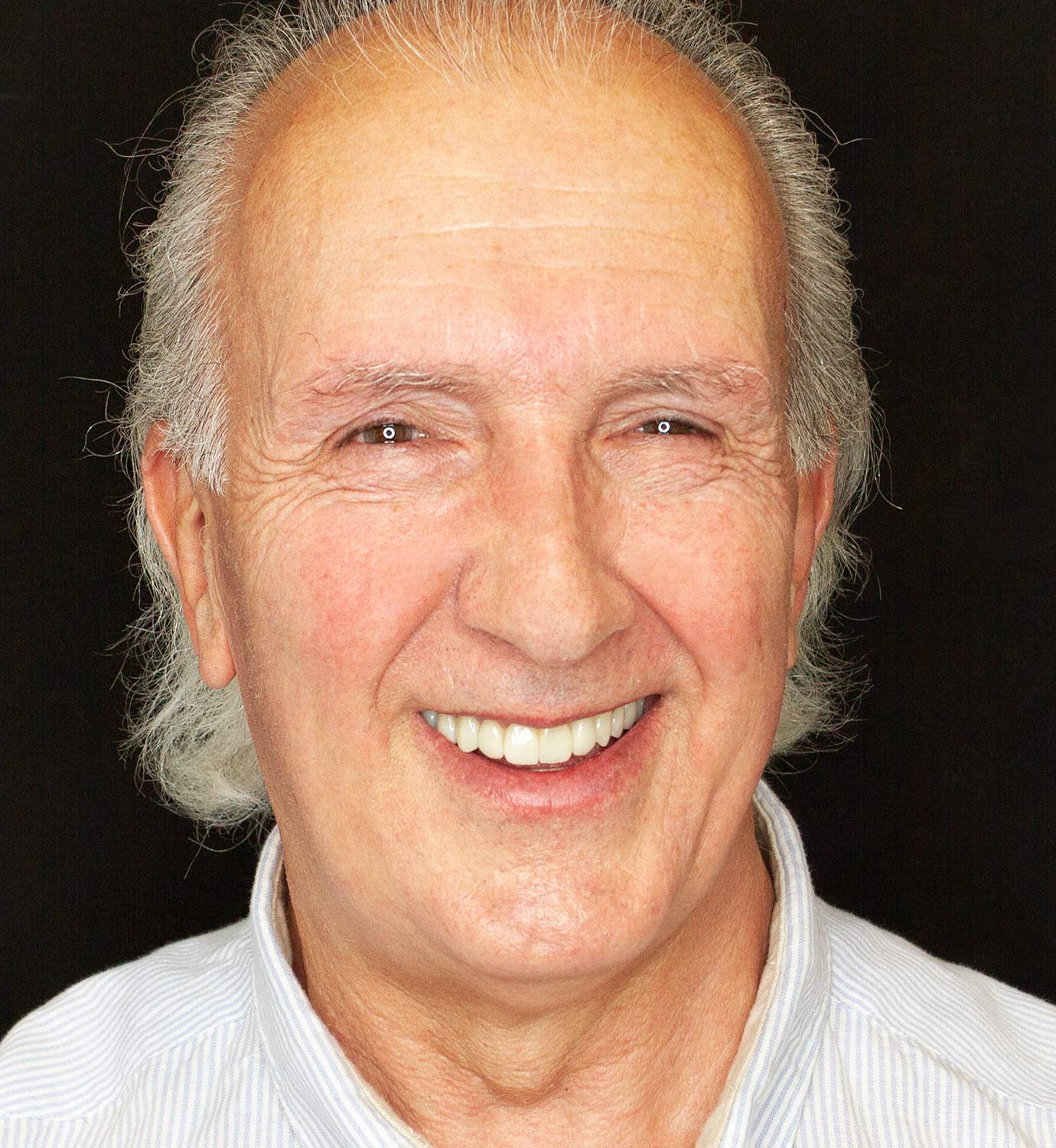 fotografía de después