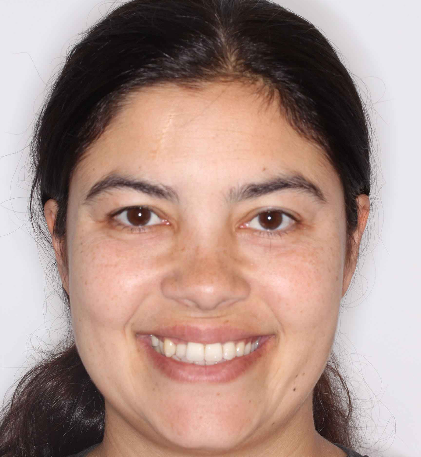 fotografía de antes