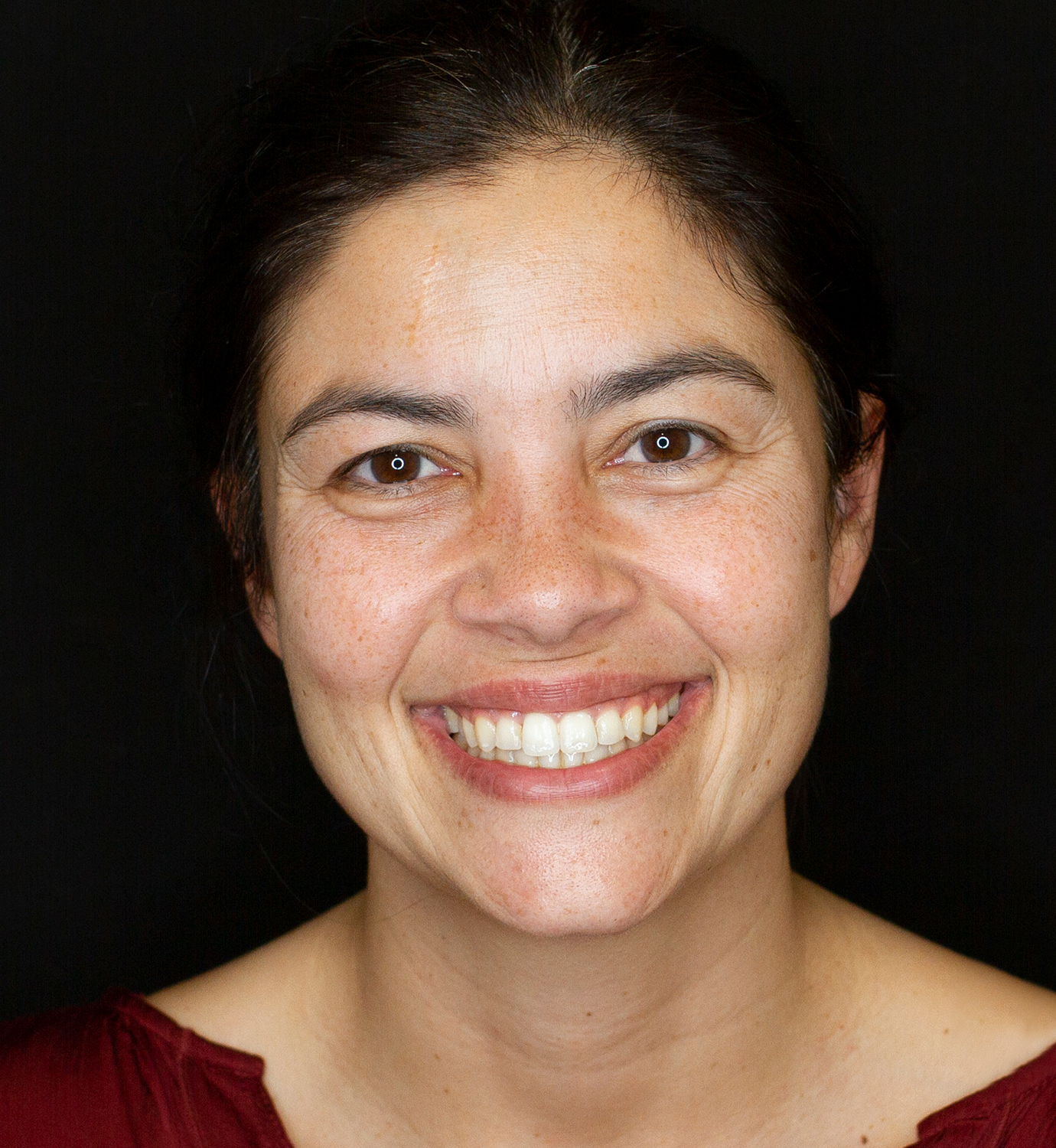 fotografía de después