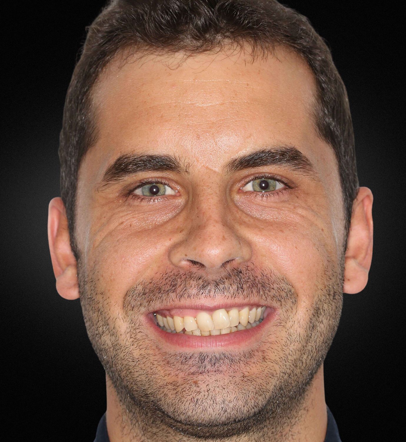 fotografía de antes