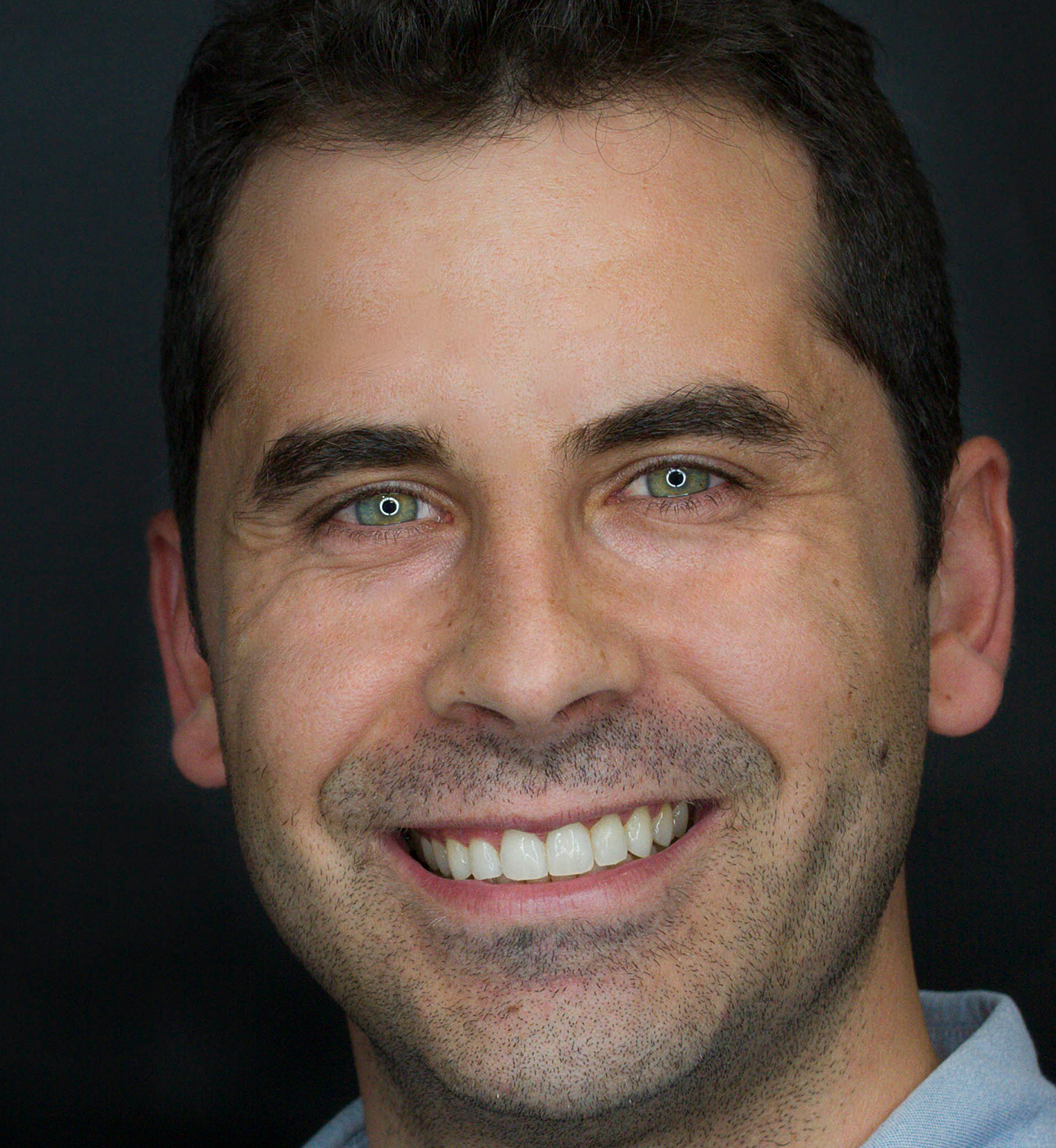 fotografía de después