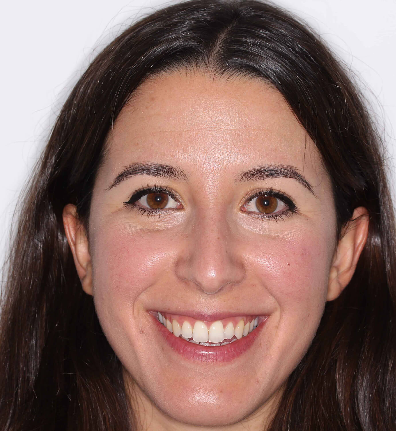 fotografía de antes