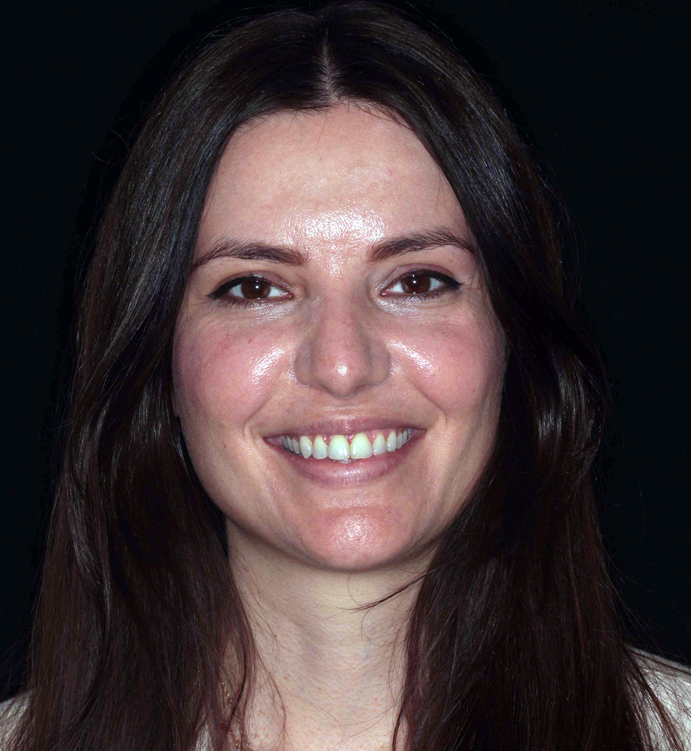 fotografía de antes