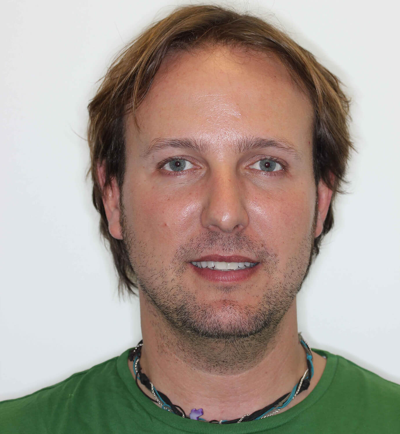 fotografía de antes