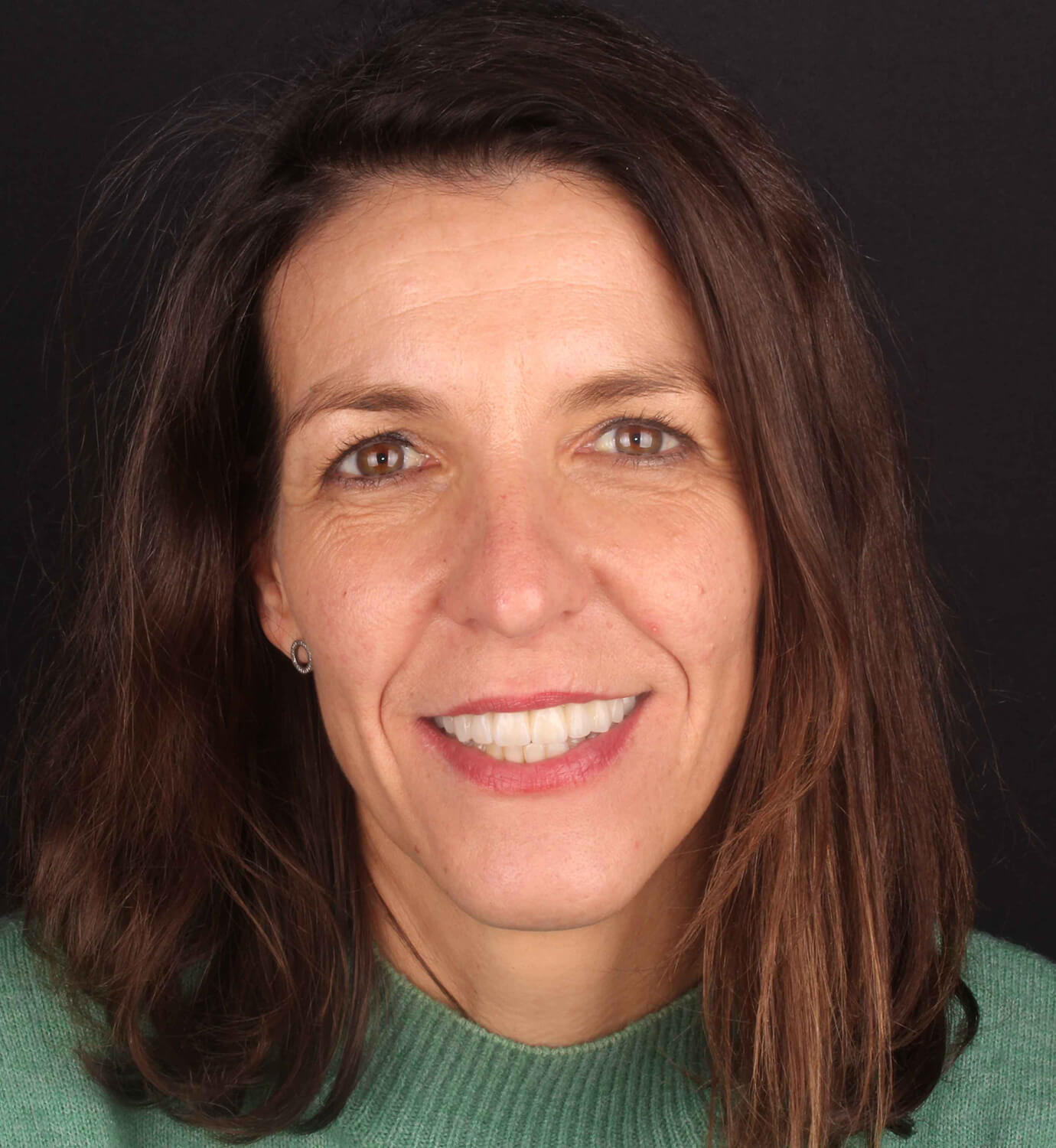 fotografía de después