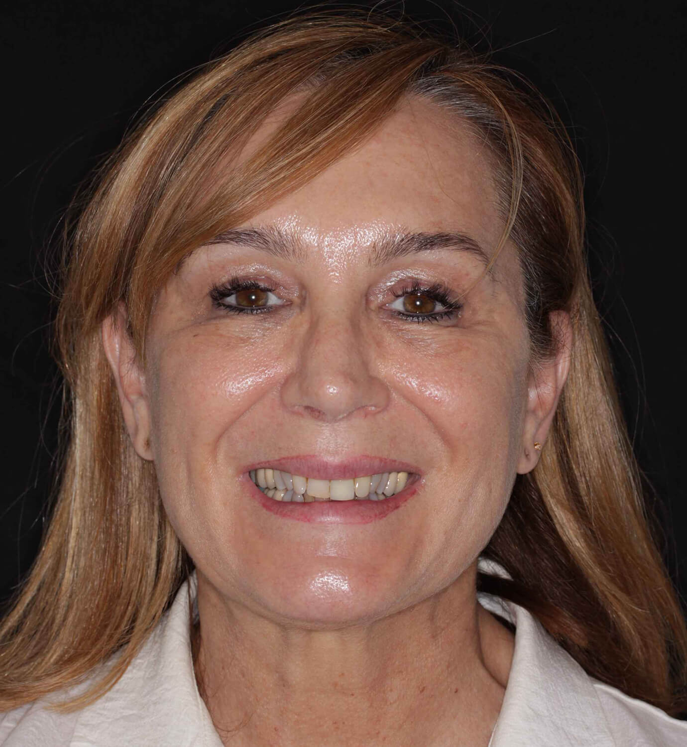 fotografía de antes