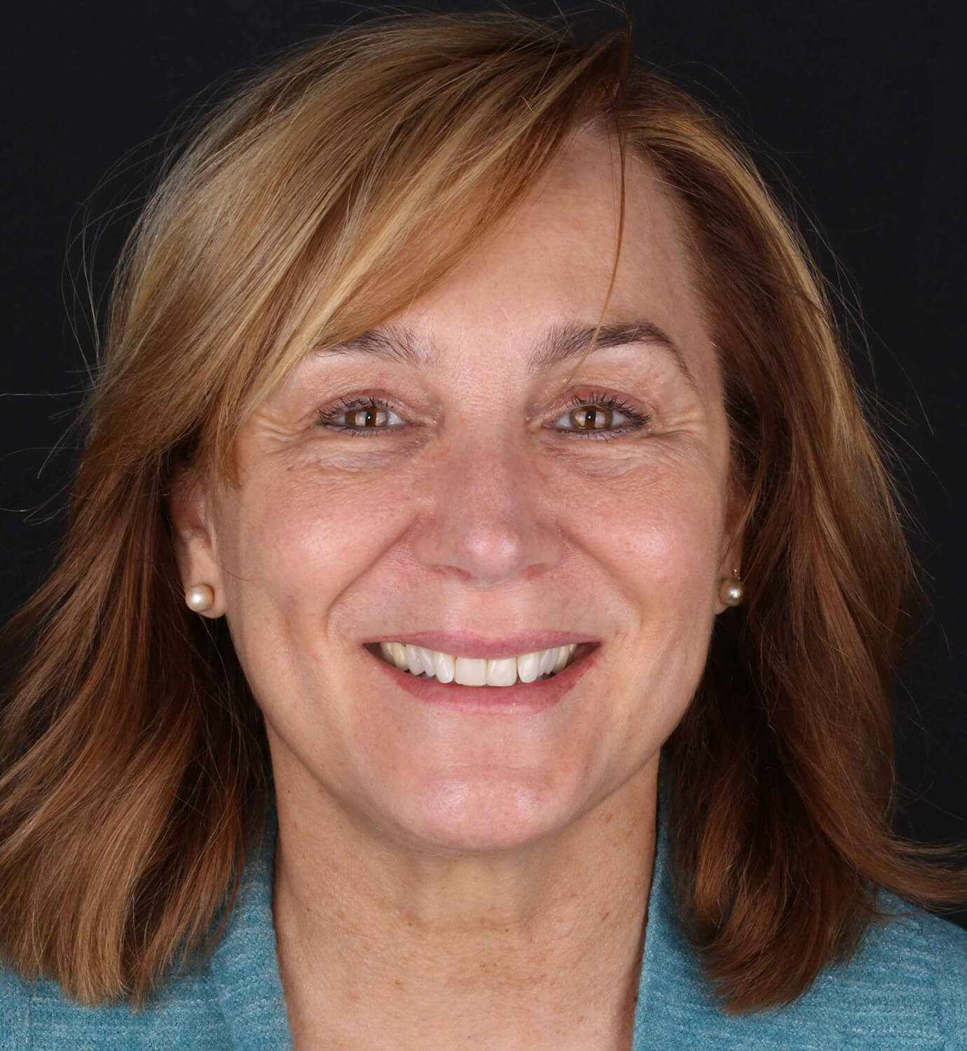 fotografía de después