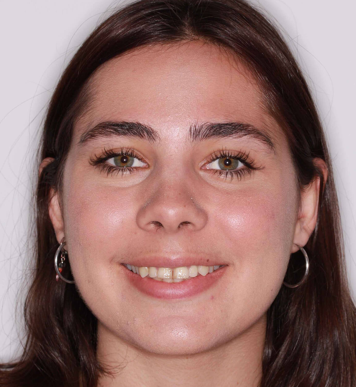 fotografía de antes