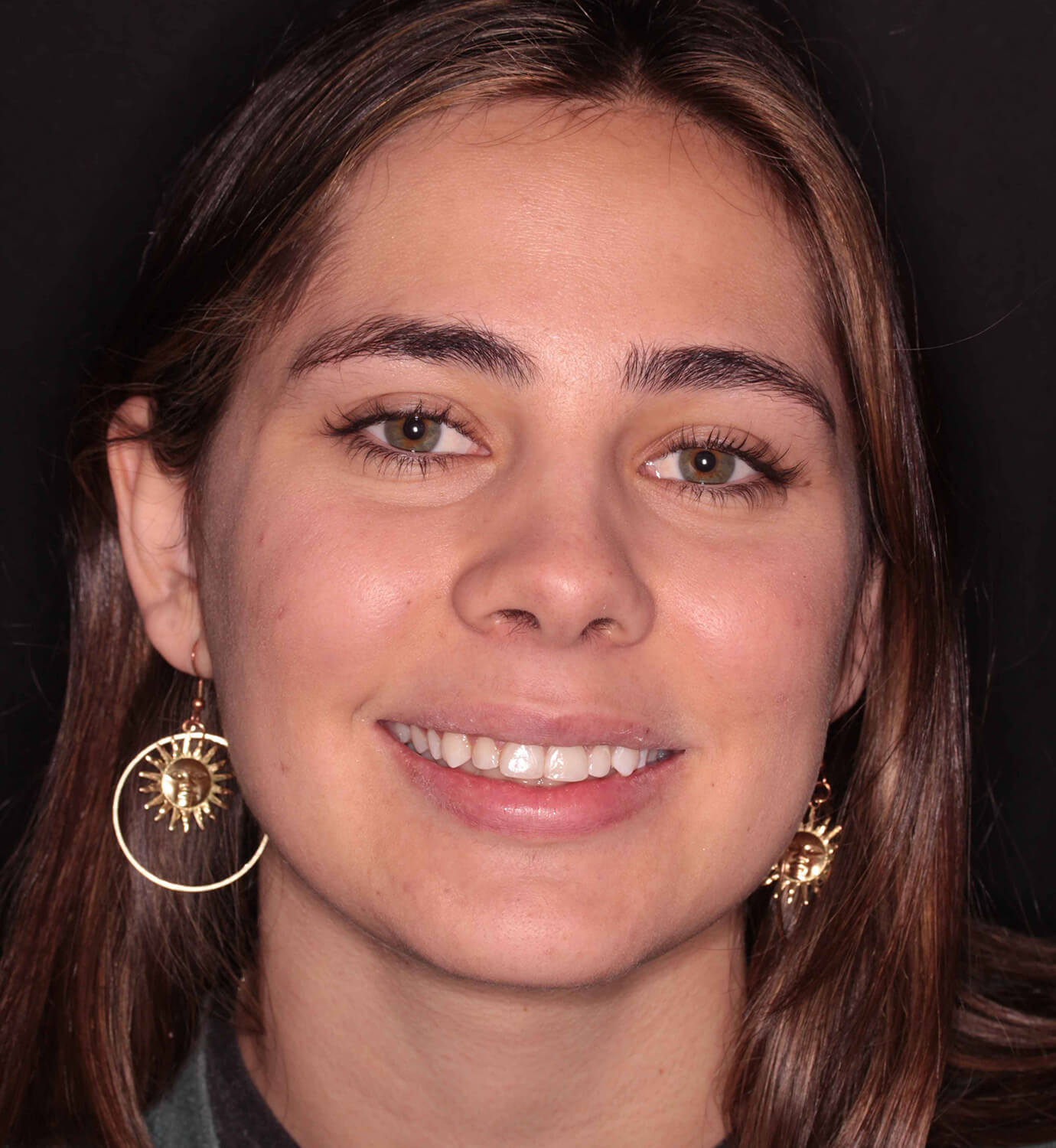 fotografía de después