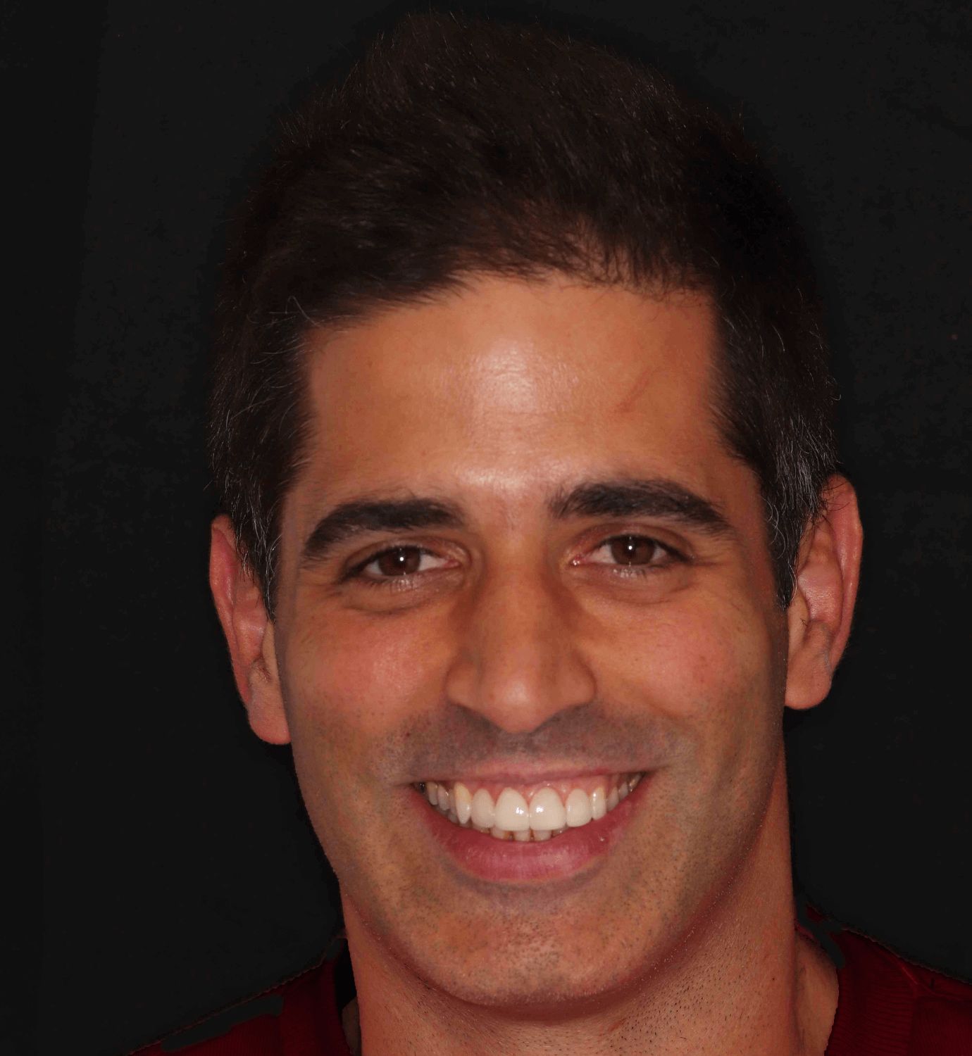 fotografía de después