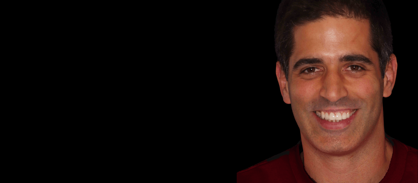 Experiencia de carillas dentales