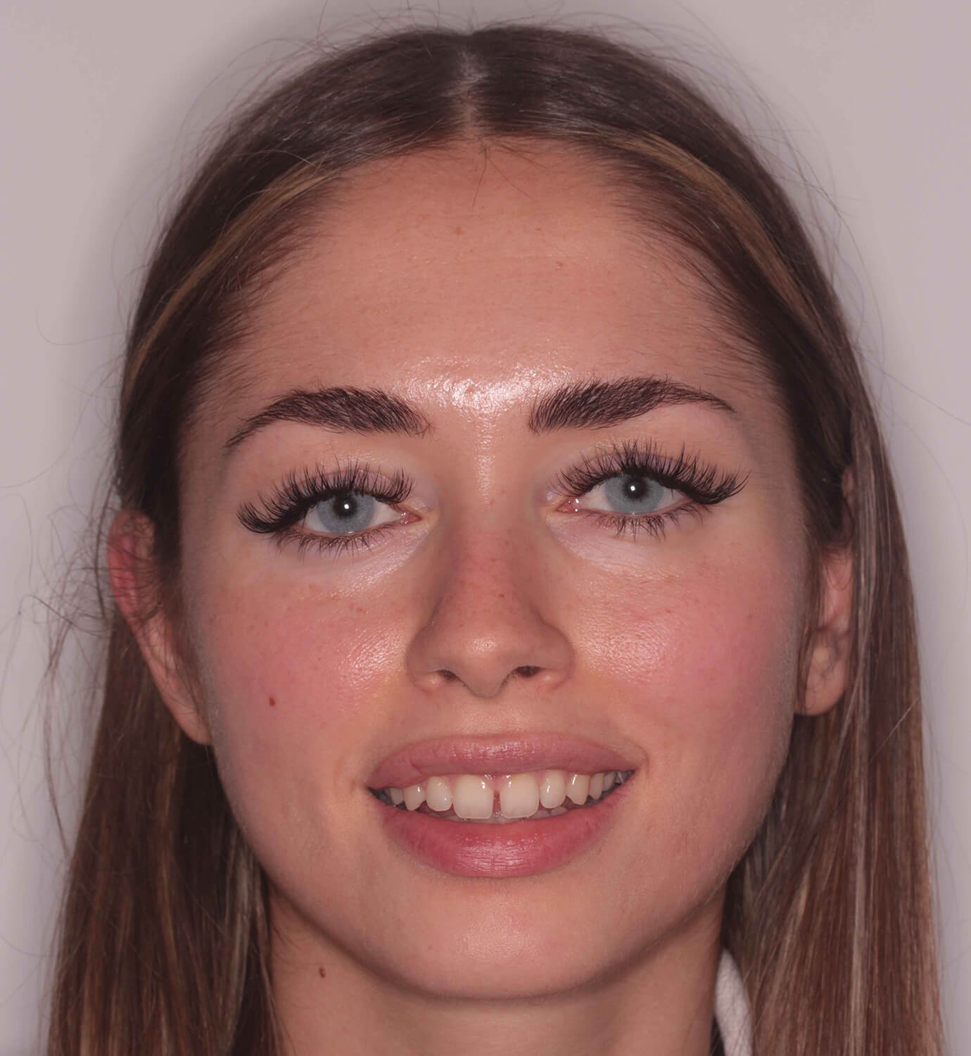 fotografía de antes