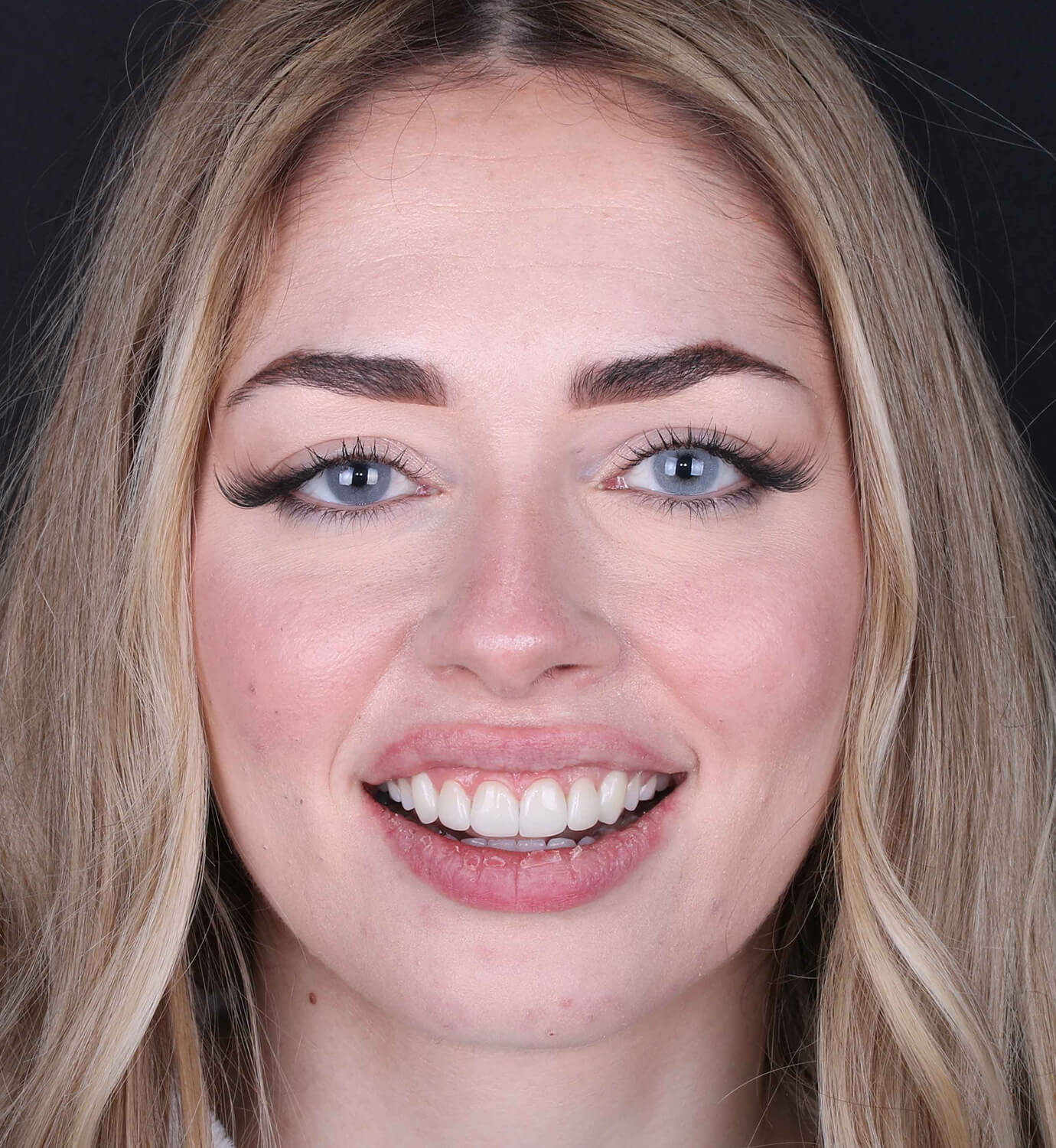 fotografía de después