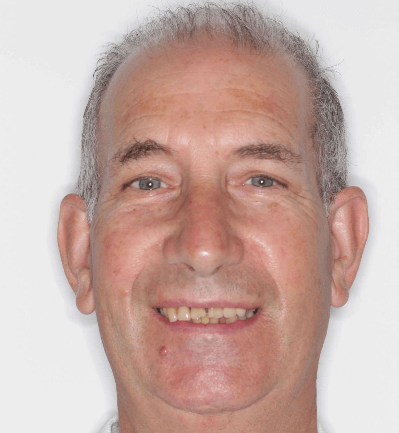 fotografía de antes