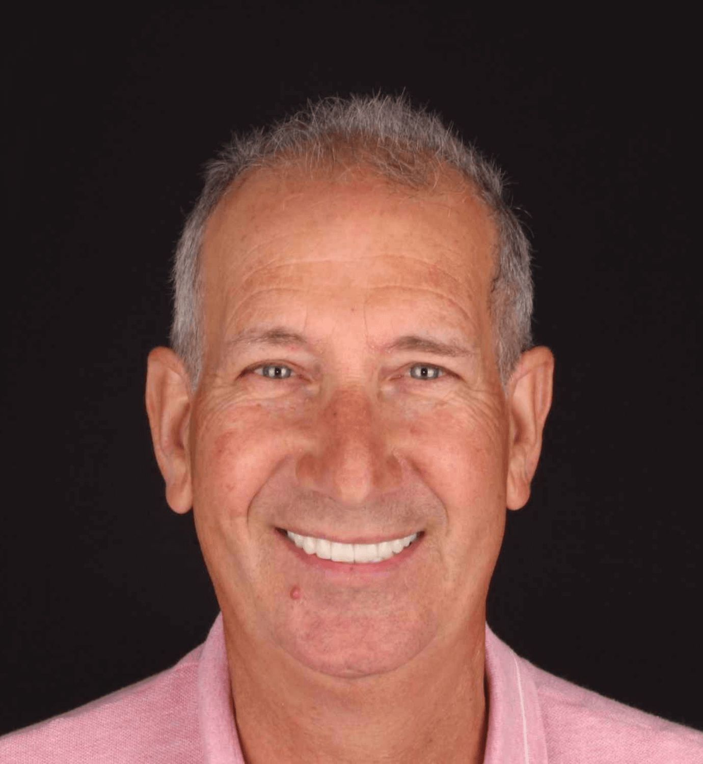 fotografía de después