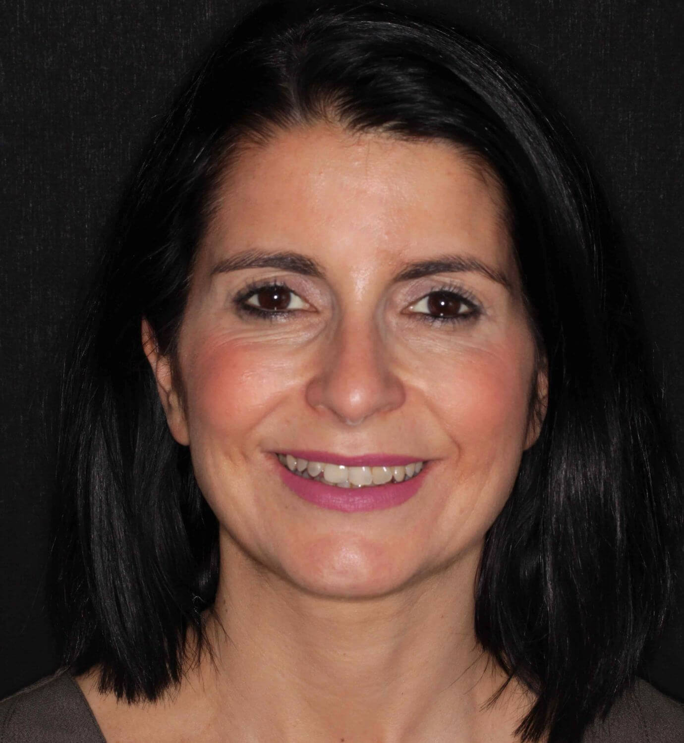 fotografía de antes