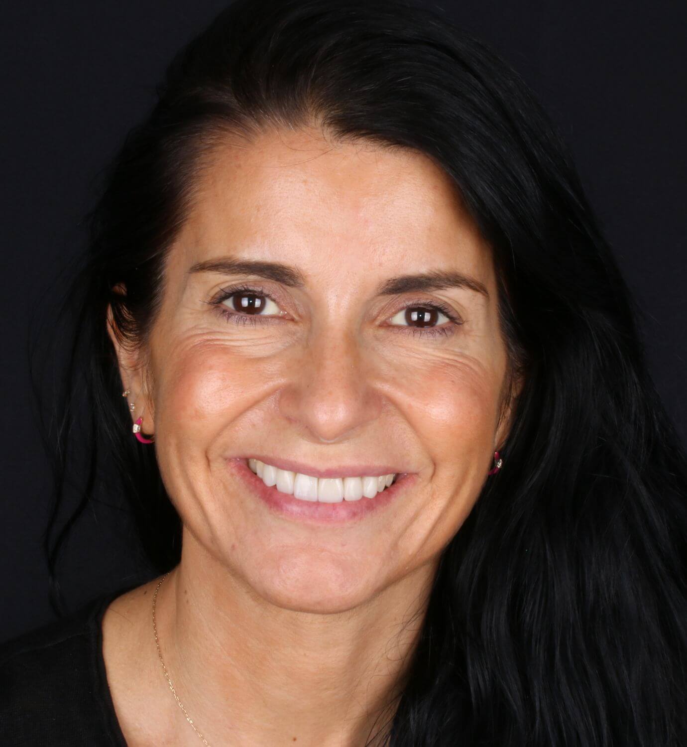 fotografía de después