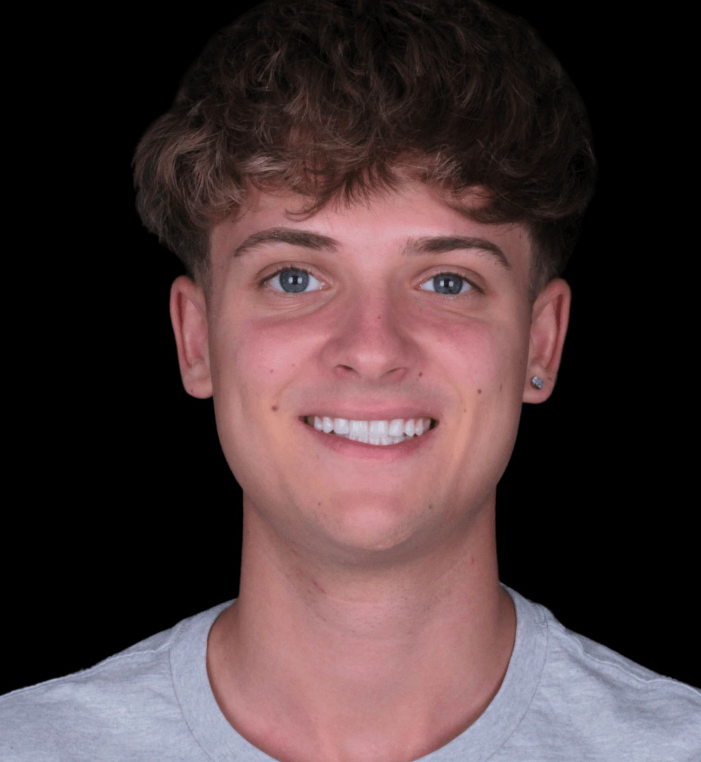 fotografía de después