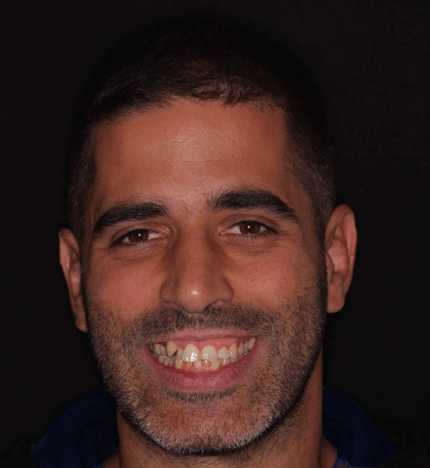 fotografía de antes