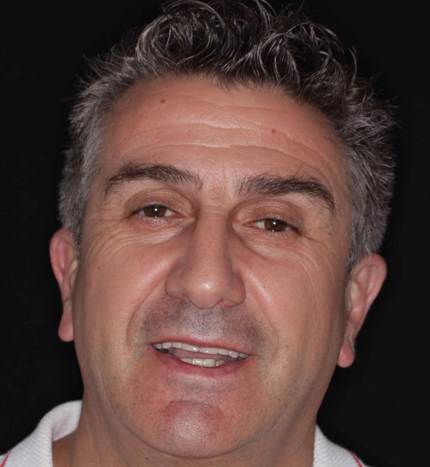 fotografía de antes