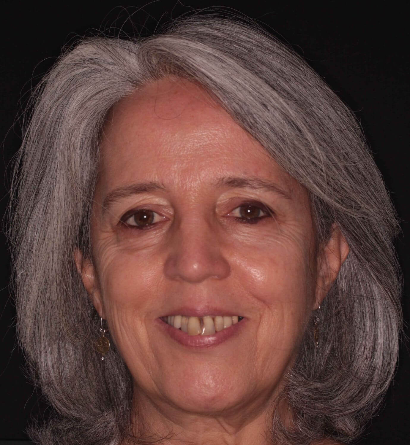 fotografía de antes