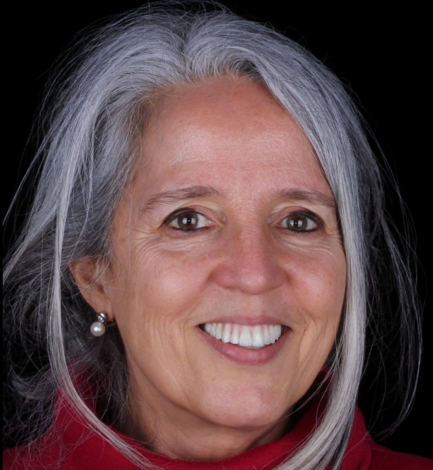 fotografía de después