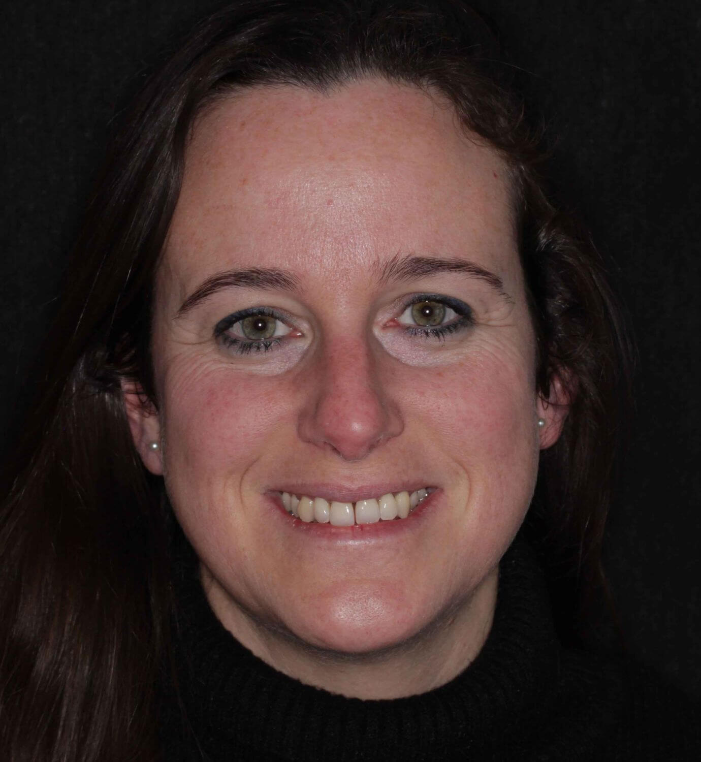 fotografía de antes