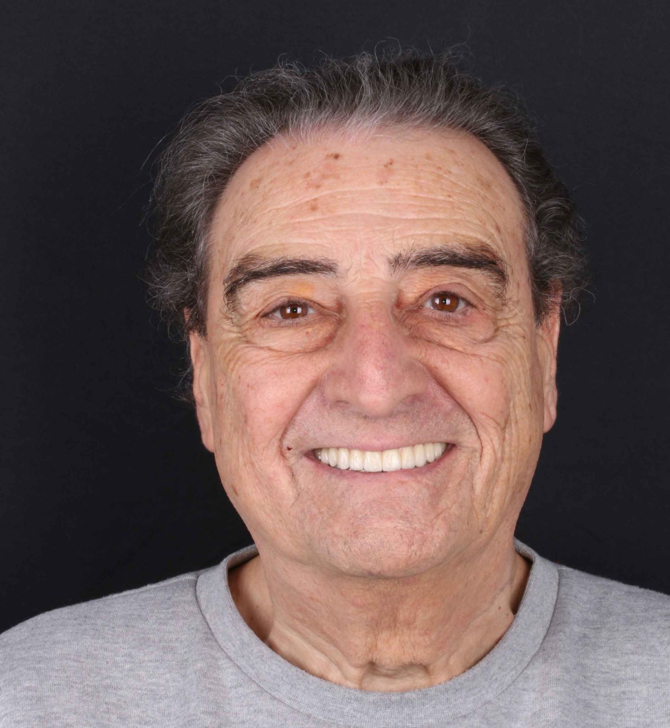 fotografía de después