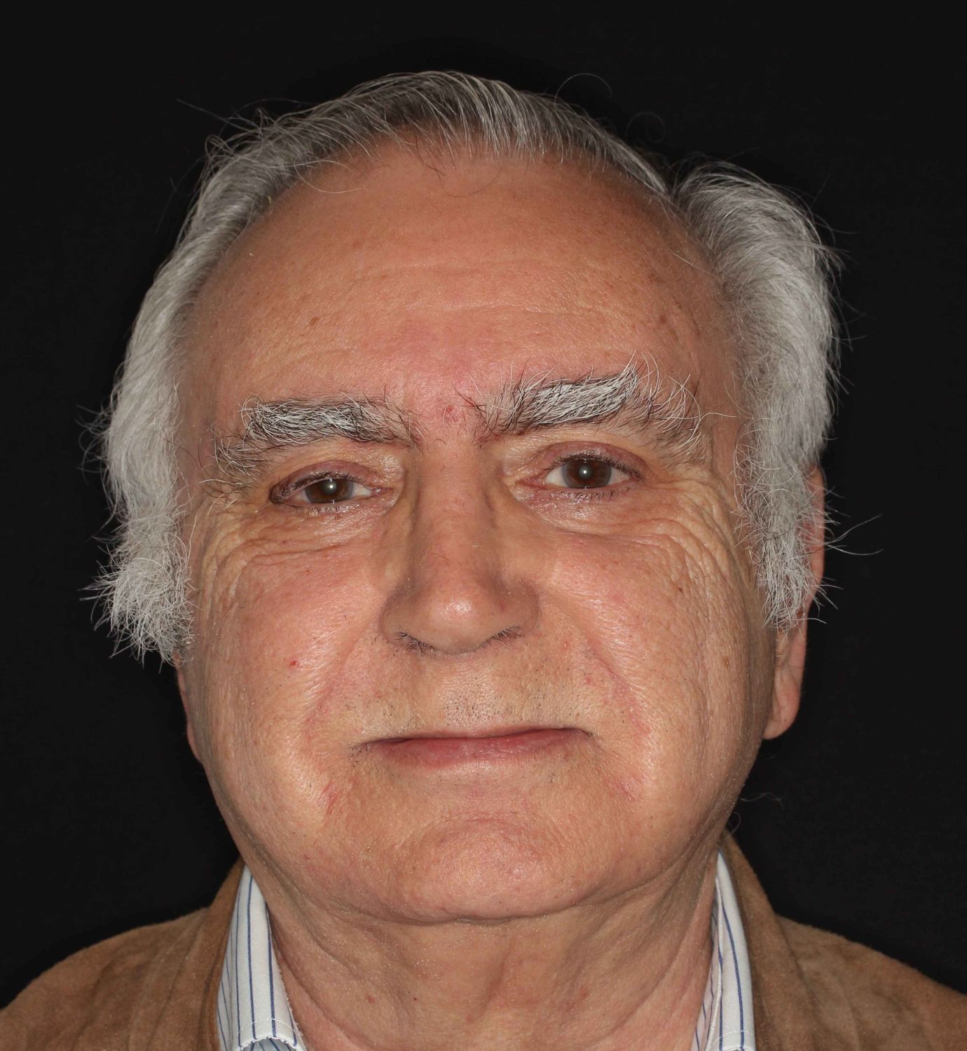 fotografía de antes