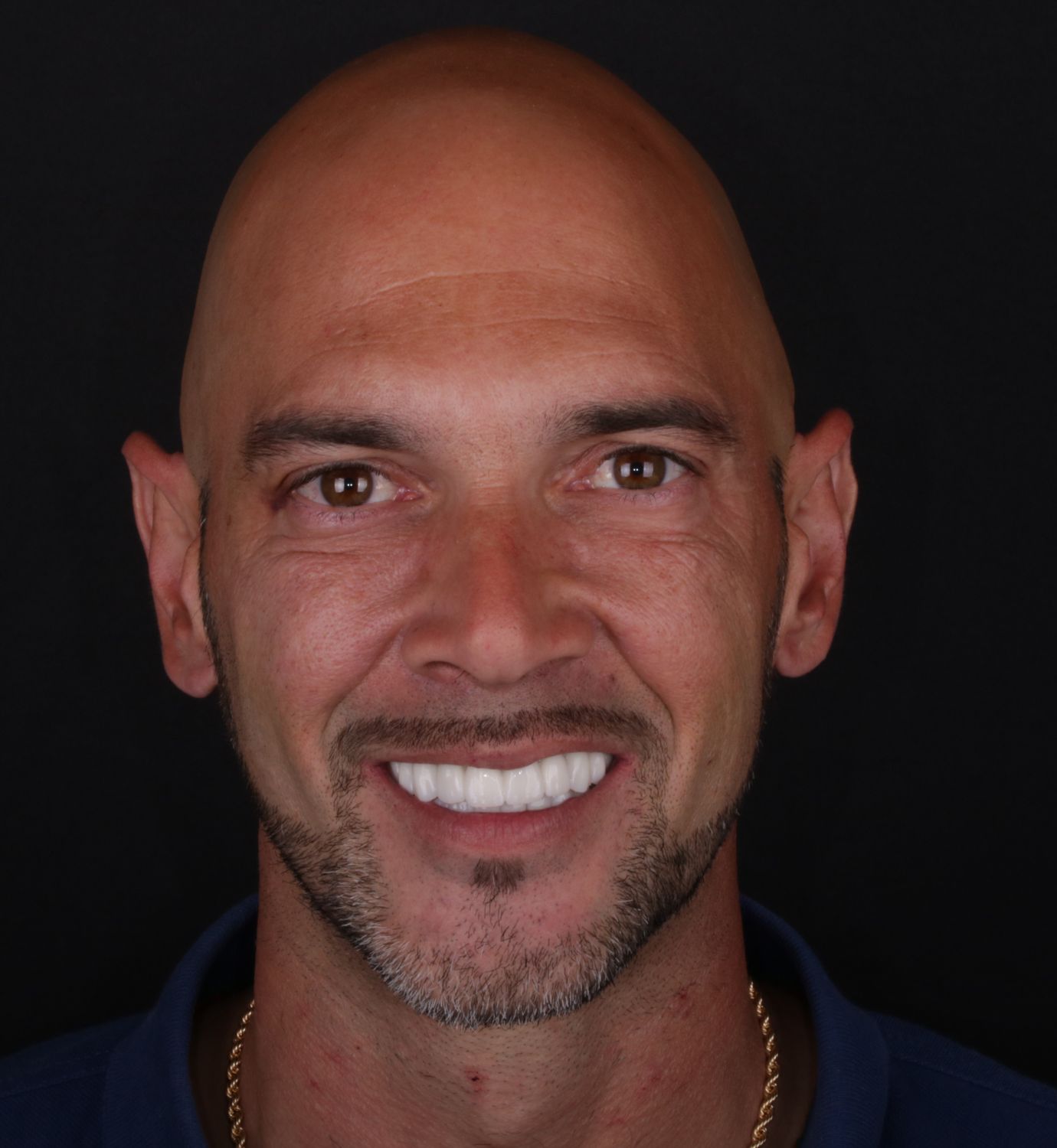 fotografía de después