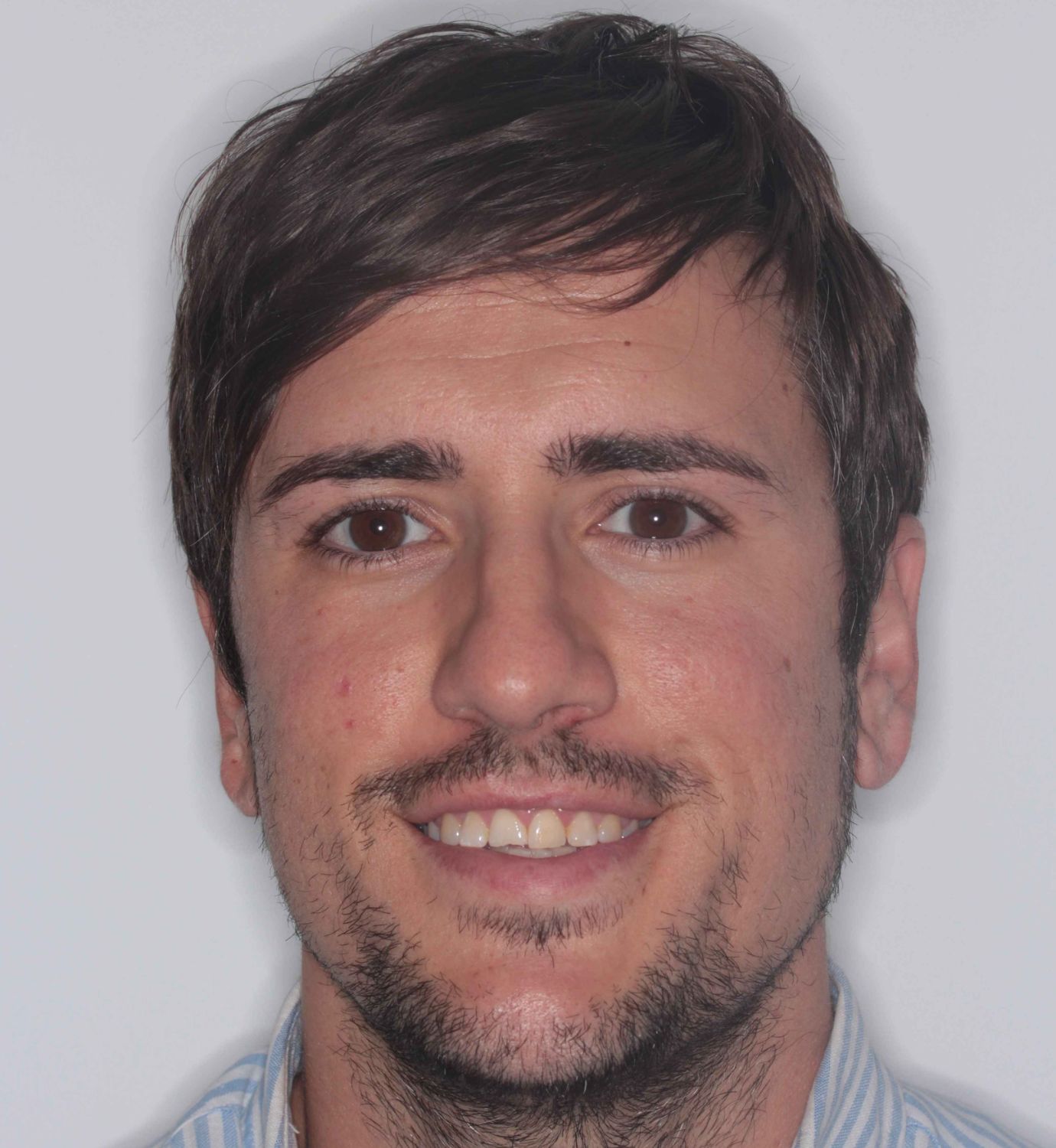 fotografía de antes