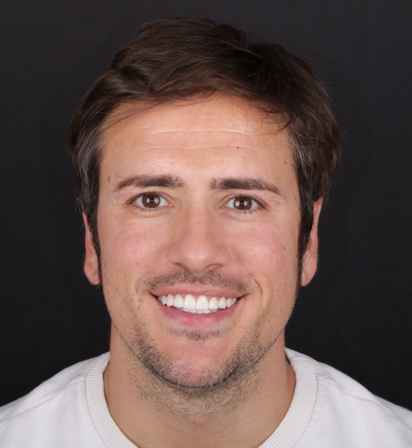 fotografía de después