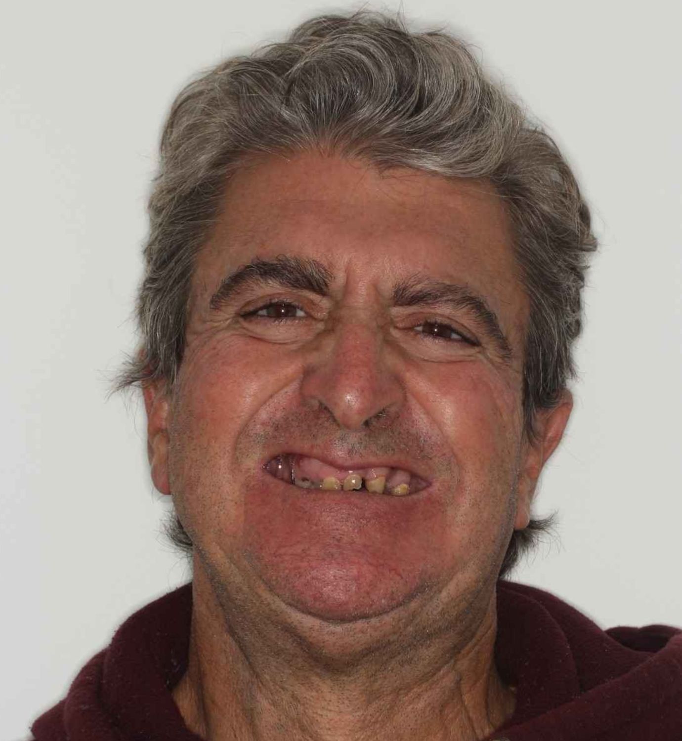 fotografía de antes