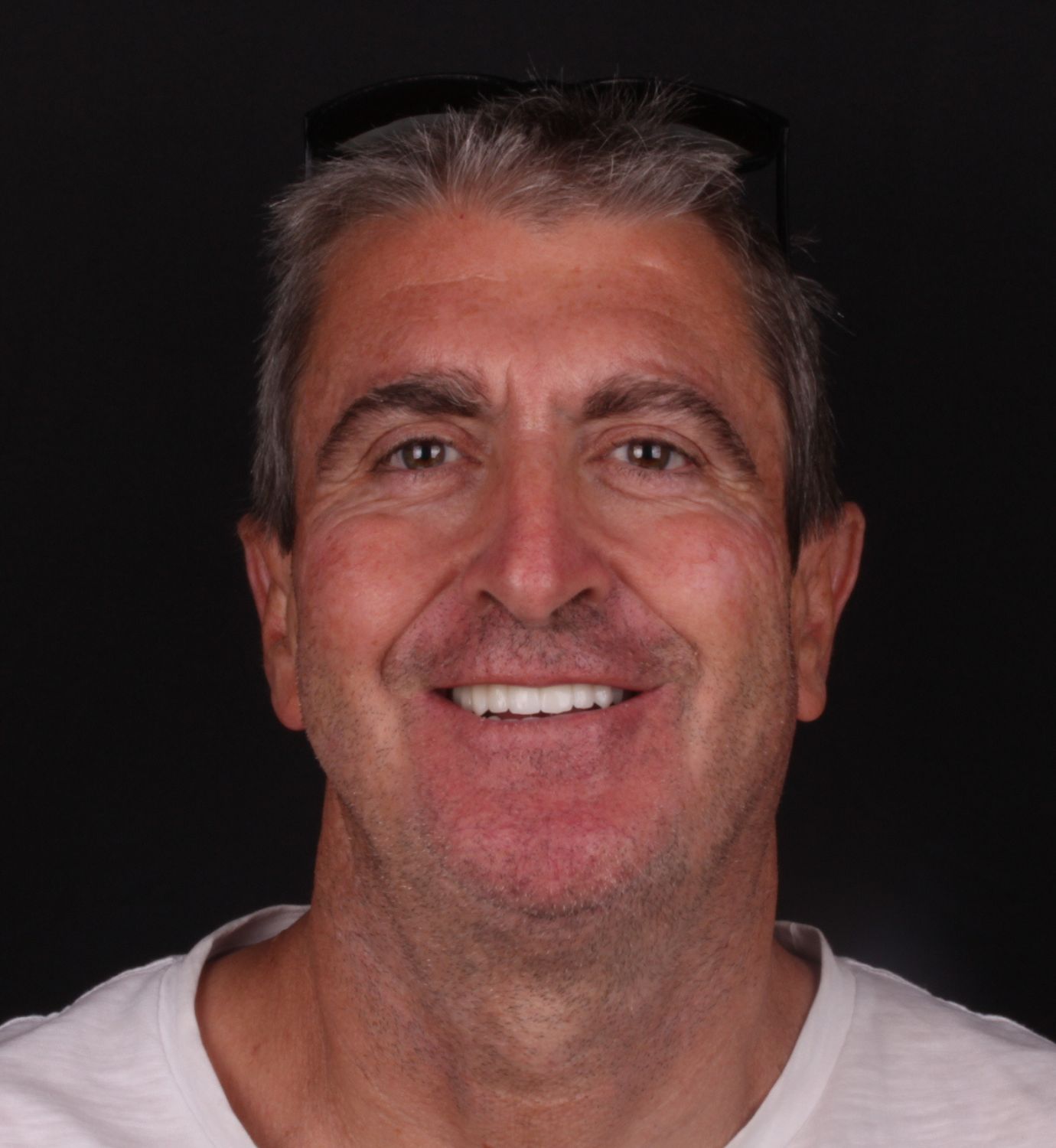 fotografía de después