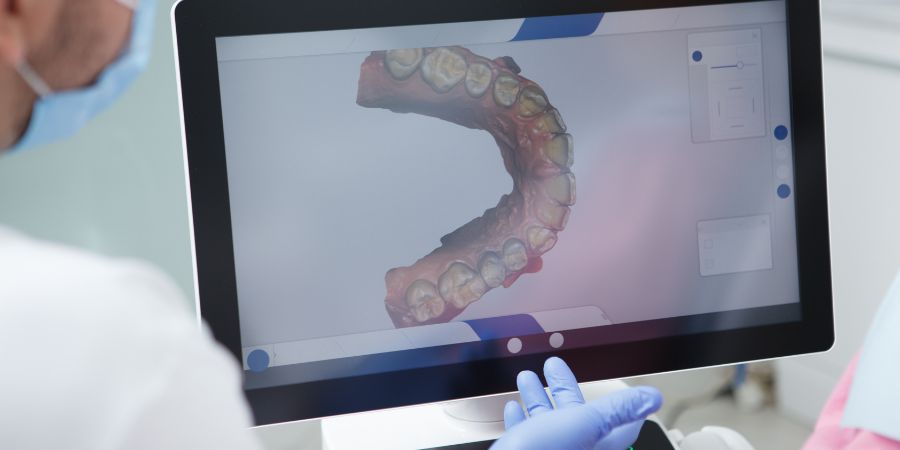 Ortodoncia con férulas transparentes
