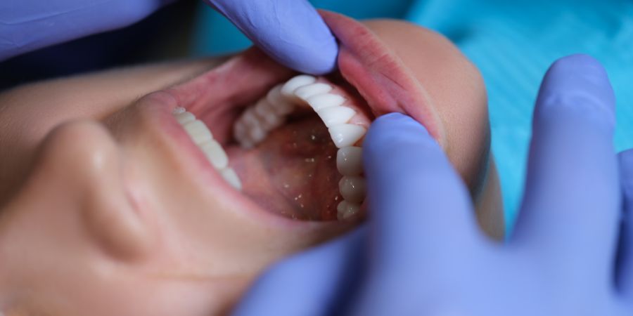 Ortodoncia con férulas transparentes