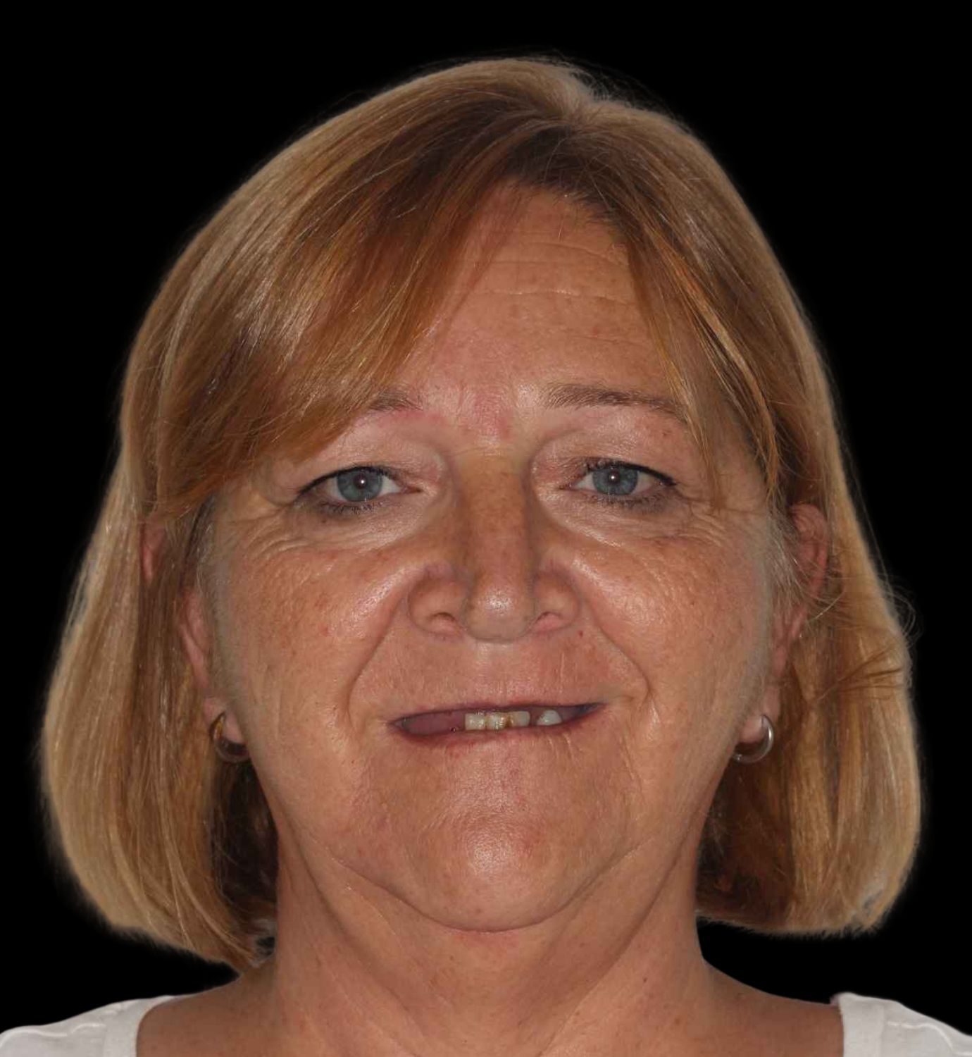 fotografía de antes