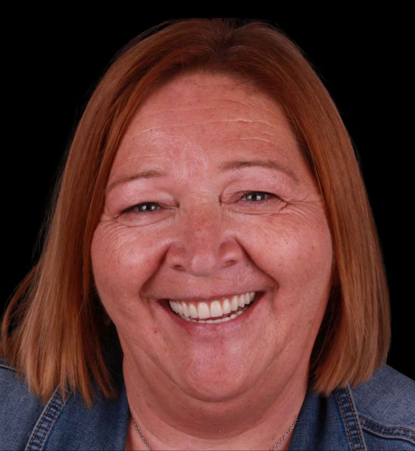 fotografía de después