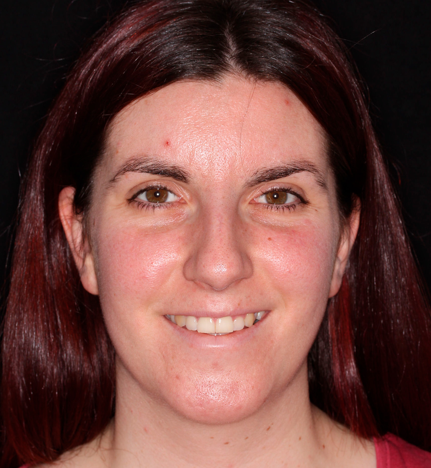 fotografía de antes