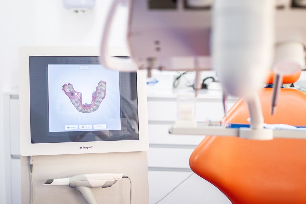 Escáner intraoral en 3D para implantes