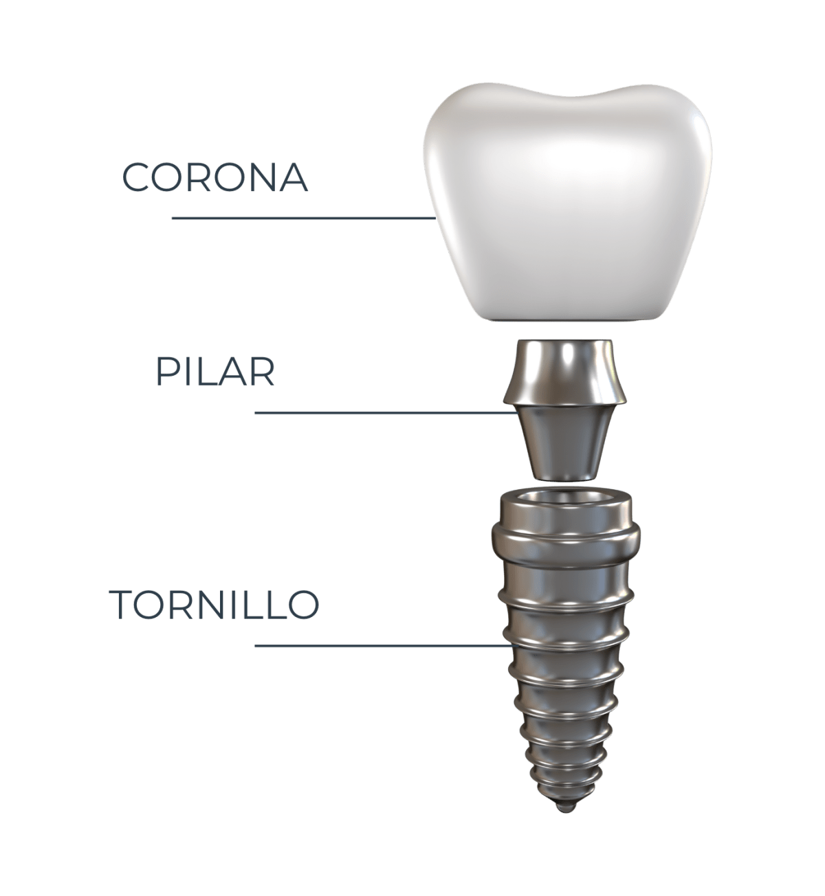 Anatom a Del Implante Dental Implantes Dentales Dra Mar a anatom-a-del-implante-dental-implantes-dentales-dra-mar-a