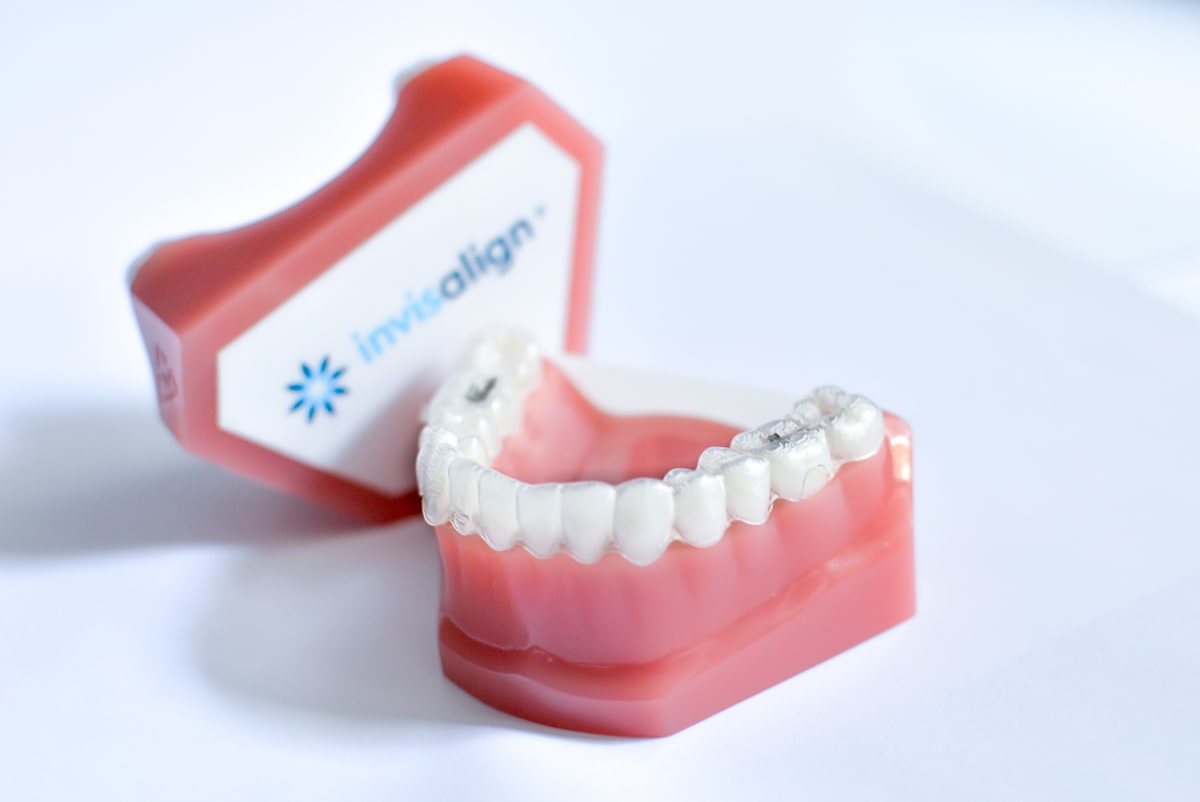 Que Es Invisalign: ¿Funciona? ¿es Realmente Invisible? - BordonClinic