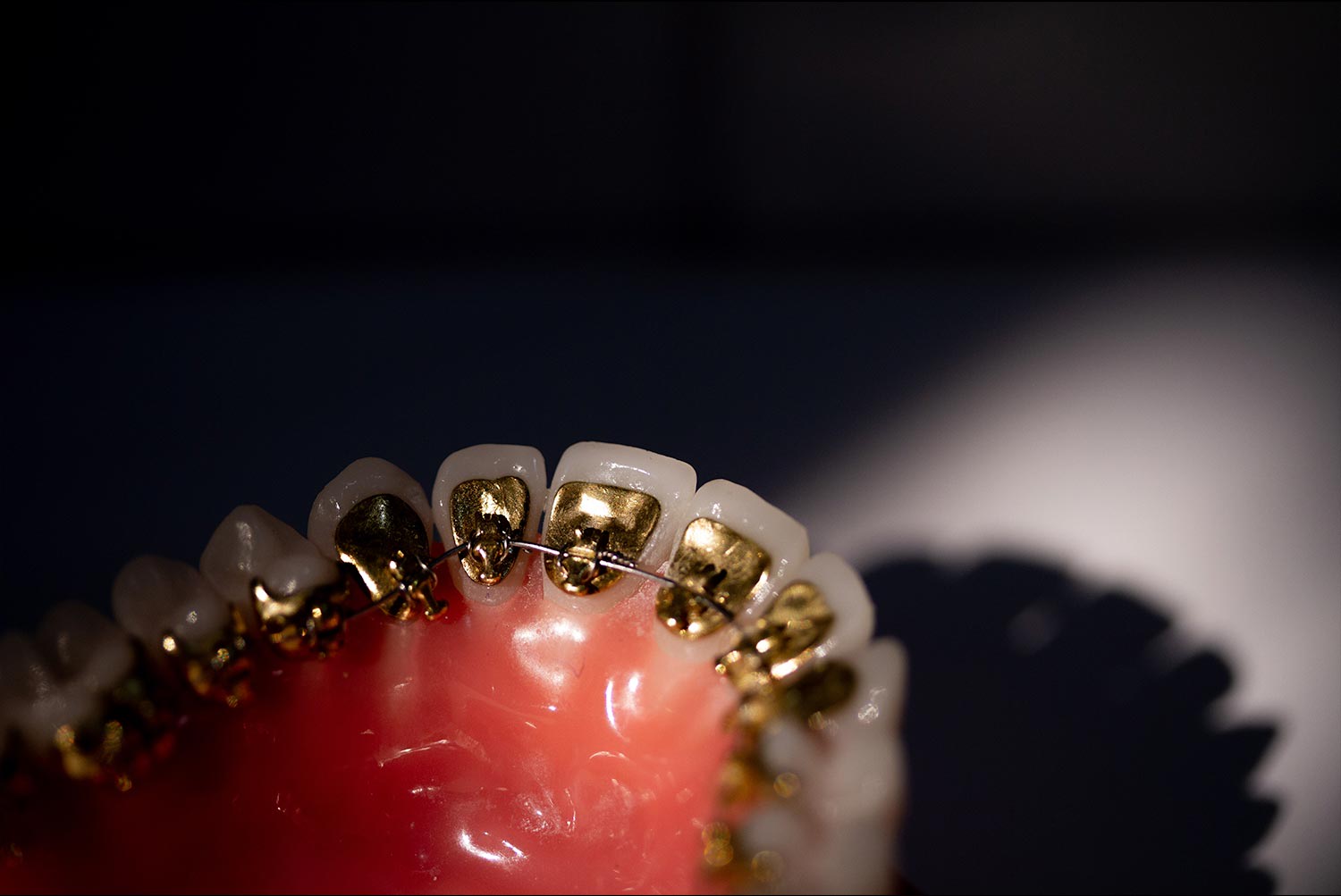 Dentista sin dolor en Madrid