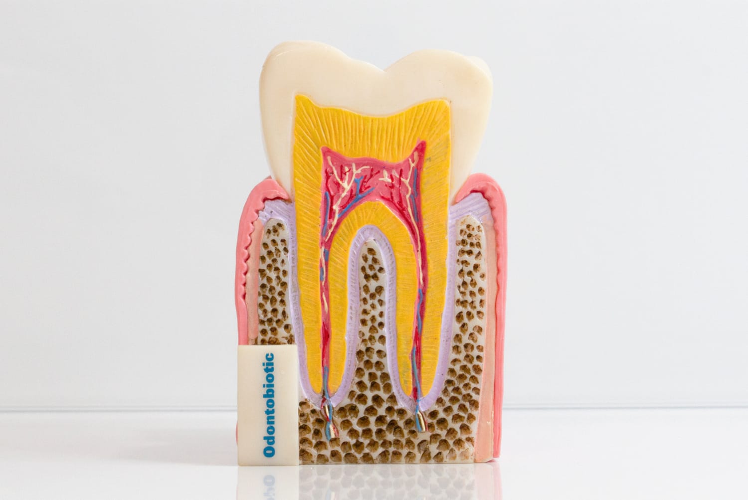 Ortodoncia con brackets estéticos de zafiro
