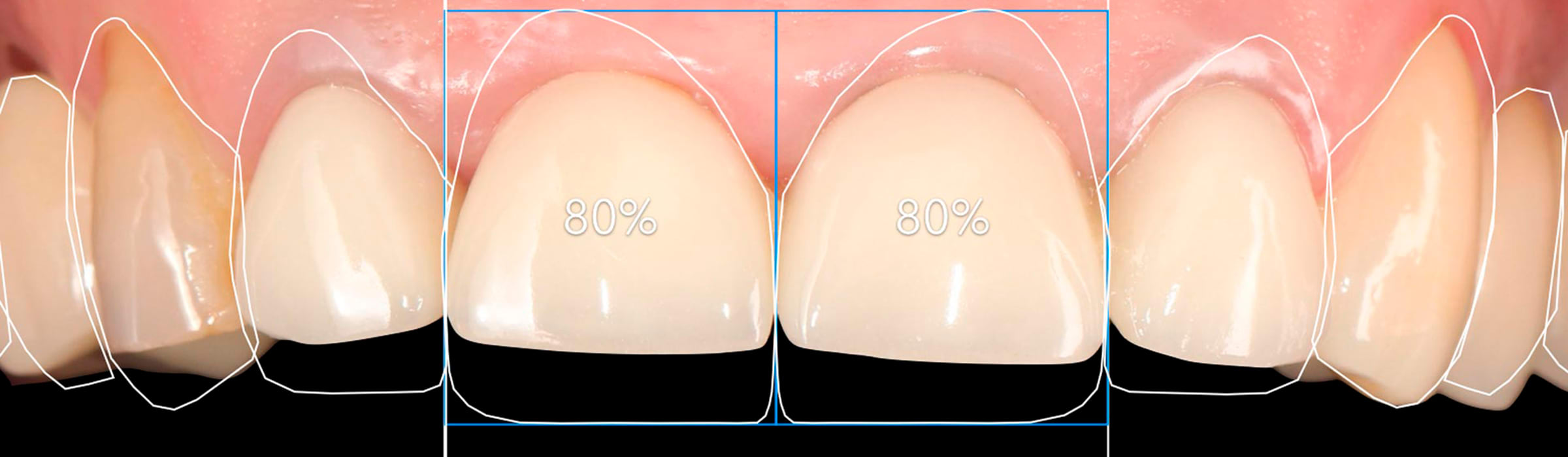 Dentistas especializados en cirugía en Madrid