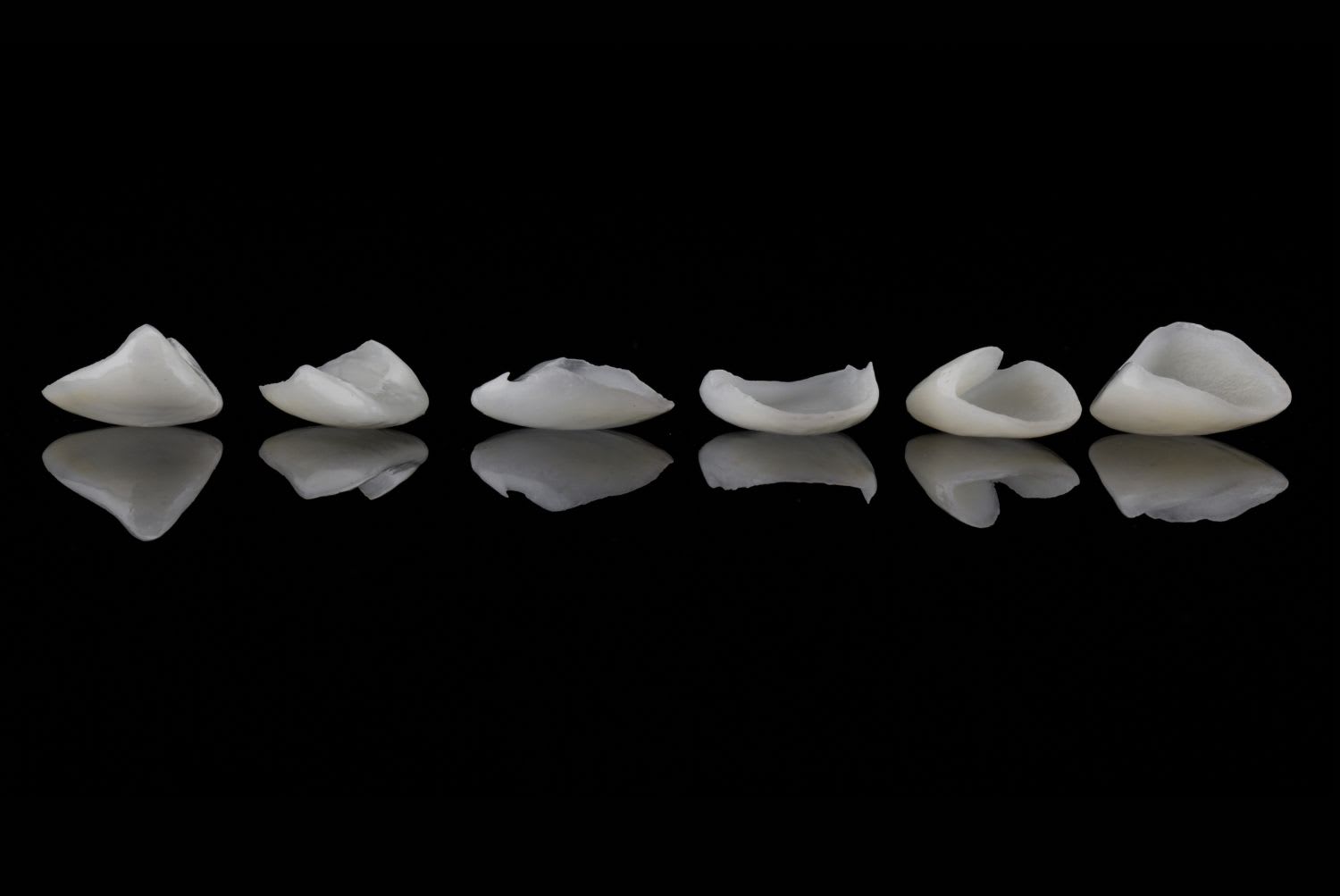 Prótesis dental removible